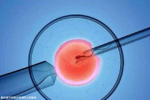 代生选性别包男孩
